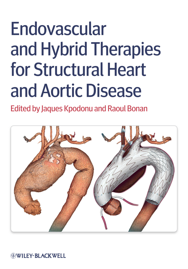 Обложка книги «Endovascular and Hybrid Therapies for Structural Heart and Aortic Disease»
