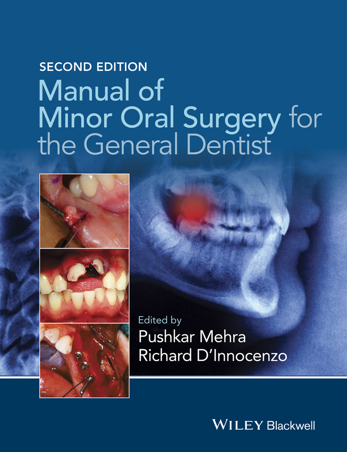 Обложка книги «Manual of Minor Oral Surgery for the General Dentist»