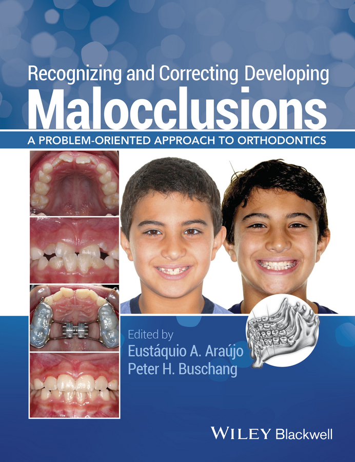 Обложка книги «Recognizing and Correcting Developing Malocclusions. A Problem-Oriented Approach to Orthodontics»