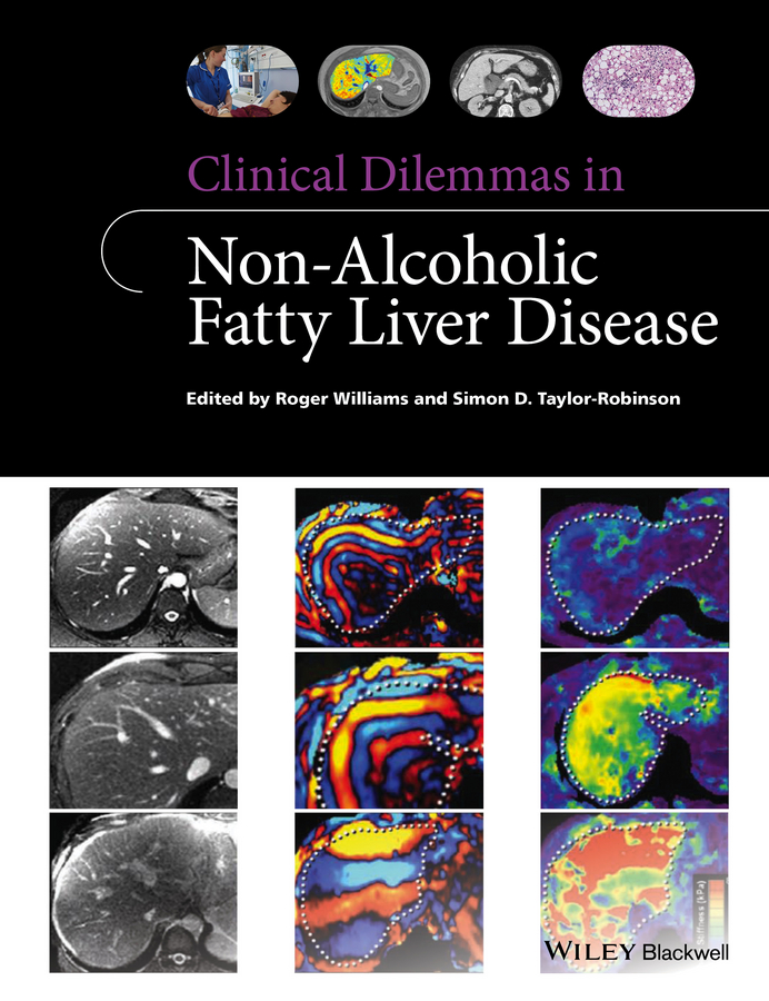 Обложка книги «Clinical Dilemmas in Non-Alcoholic Fatty Liver Disease»