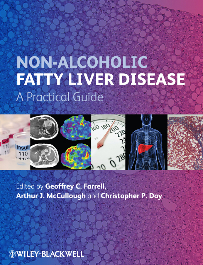 Обложка книги «Non-Alcoholic Fatty Liver Disease. A Practical Guide»