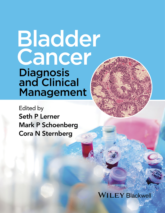 Обложка книги «Bladder Cancer. Diagnosis and Clinical Management»