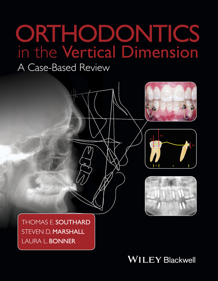 Обложка книги «Orthodontics in the Vertical Dimension. A Case-Based Review»