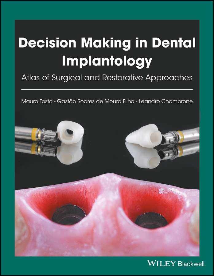 Обложка книги «Decision Making in Dental Implantology. Atlas of Surgical and Restorative Approaches»