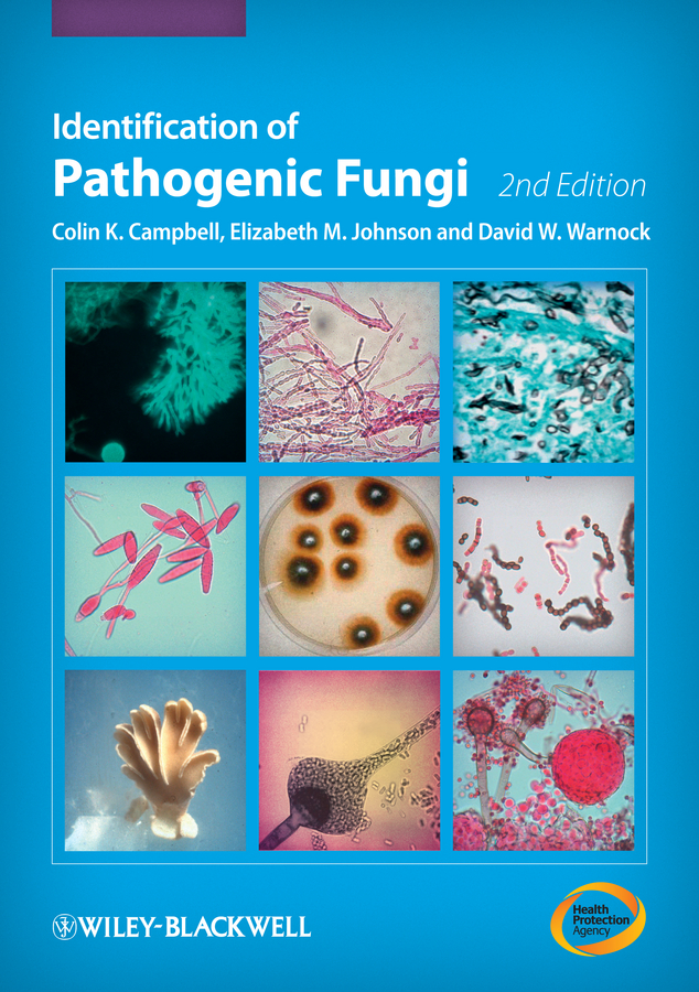 Обложка книги «Identification of Pathogenic Fungi»