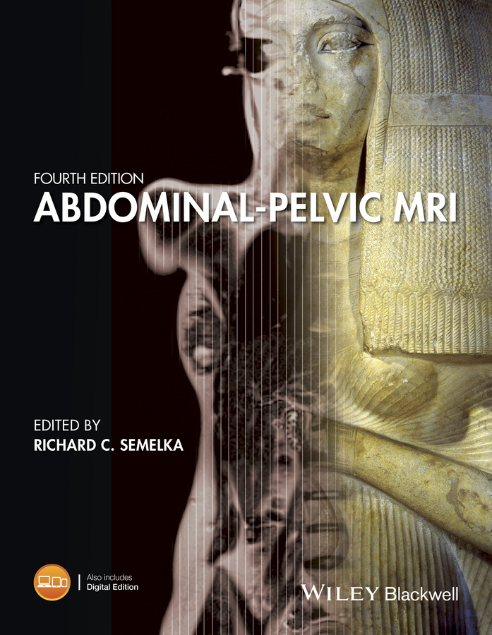 Обложка книги «Abdominal-Pelvic MRI»
