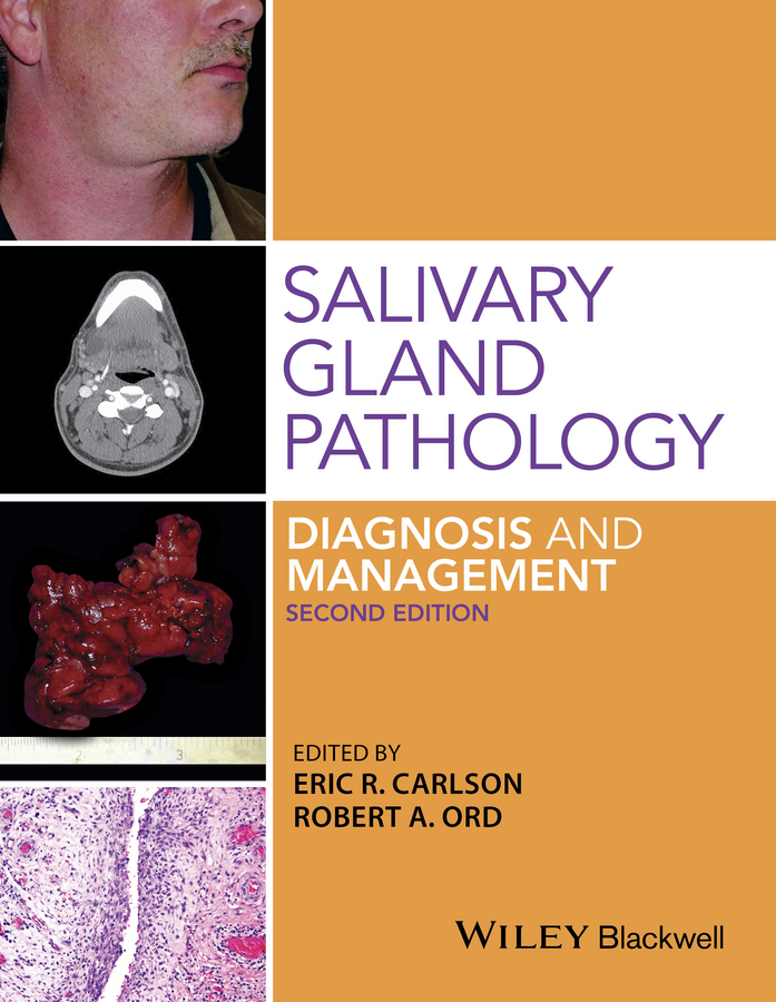 Обложка книги «Salivary Gland Pathology. Diagnosis and Management»