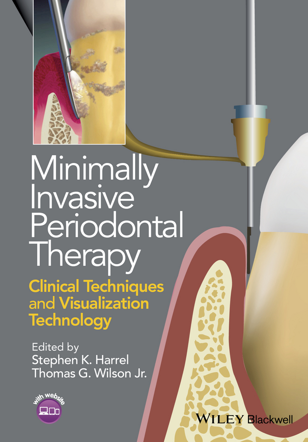 Обложка книги «Minimally Invasive Periodontal Therapy. Clinical Techniques and Visualization Technology»