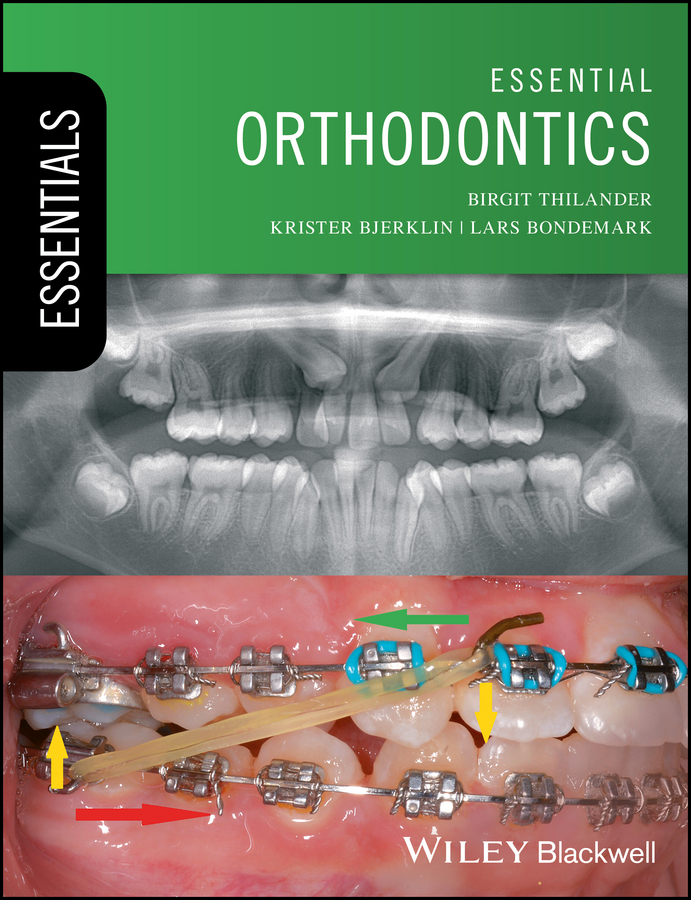Обложка книги «Essential Orthodontics»