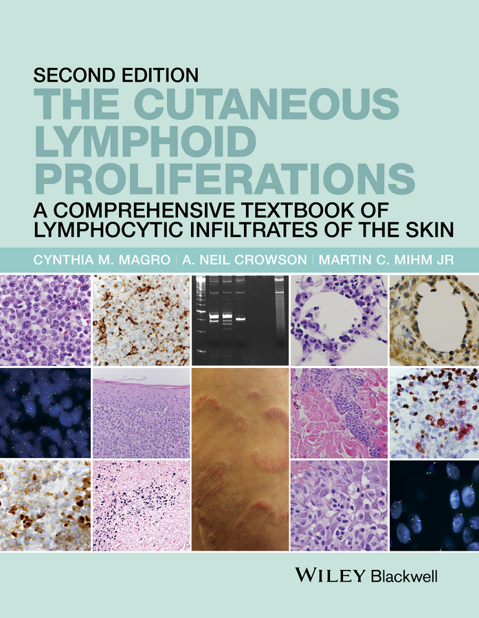 Обложка книги «The Cutaneous Lymphoid Proliferations. A Comprehensive Textbook of Lymphocytic Infiltrates of the Skin»
