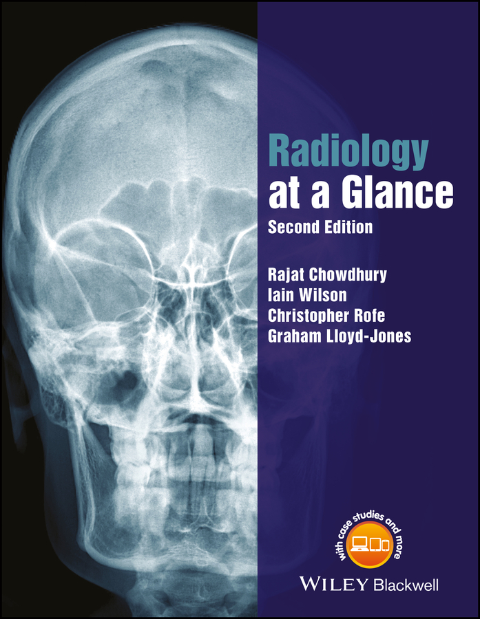 Обложка книги «Radiology at a Glance»