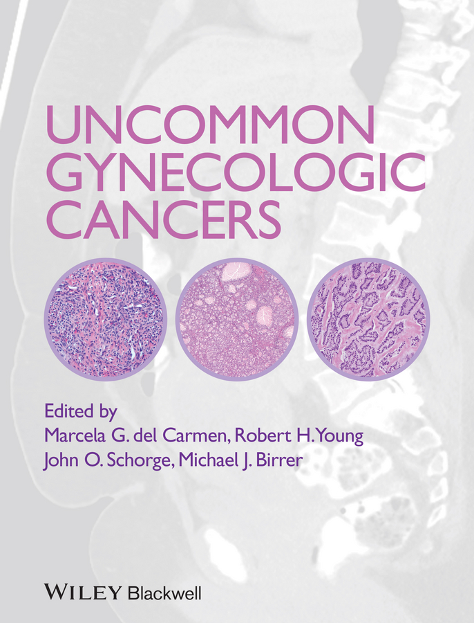 Обложка книги «Uncommon Gynecologic Cancers»