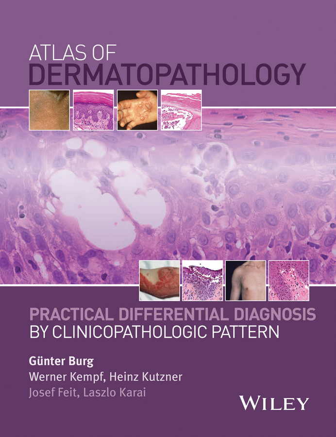 Обложка книги «Atlas of Dermatopathology. Practical Differential Diagnosis by Clinicopathologic Pattern»