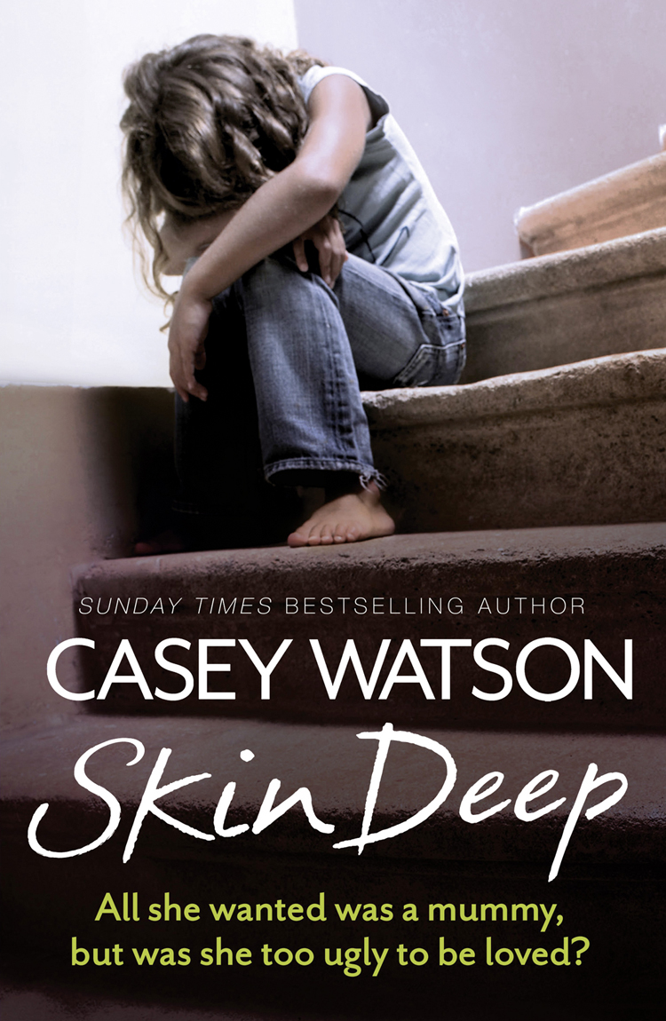 Обложка книги «Skin Deep: All She Wanted Was a Mummy, But Was She Too Ugly to Be Loved?»