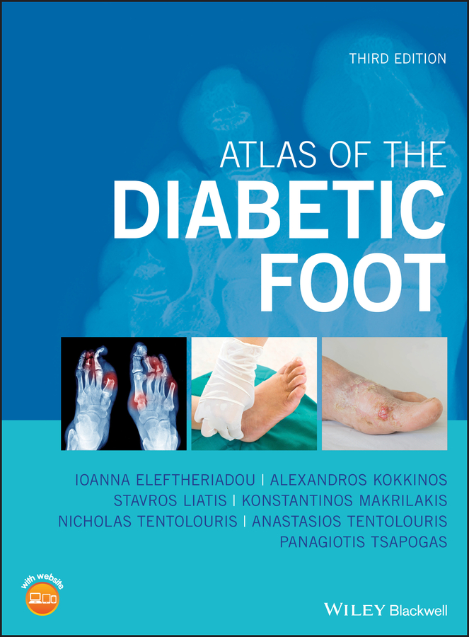 Обложка книги «Atlas of the Diabetic Foot»