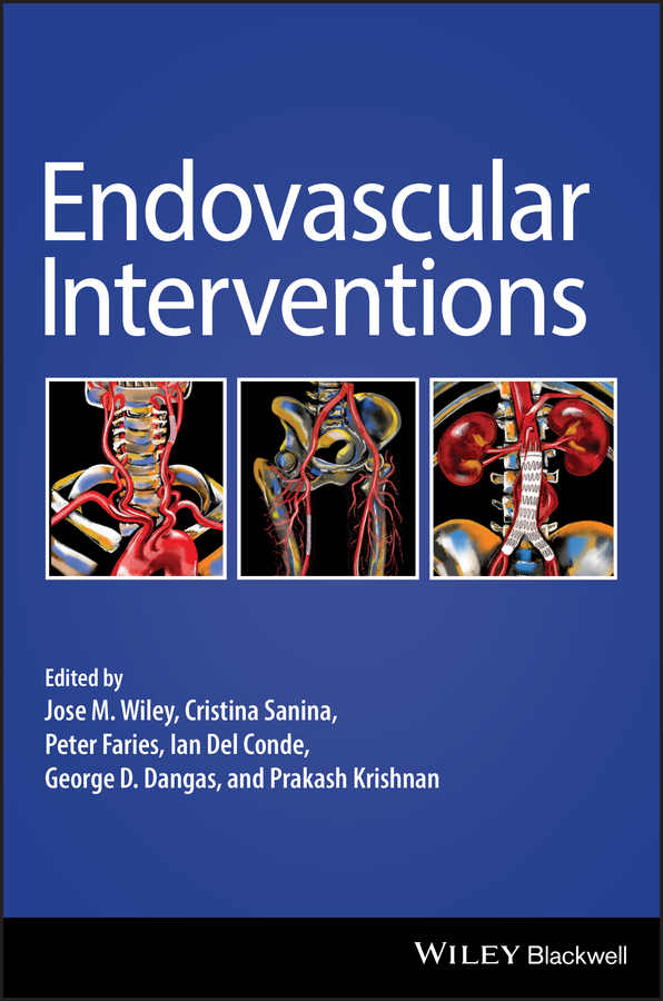 Обложка книги «Endovascular Interventions»