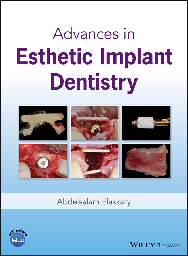 Обложка книги «Advances in Esthetic Implant Dentistry»