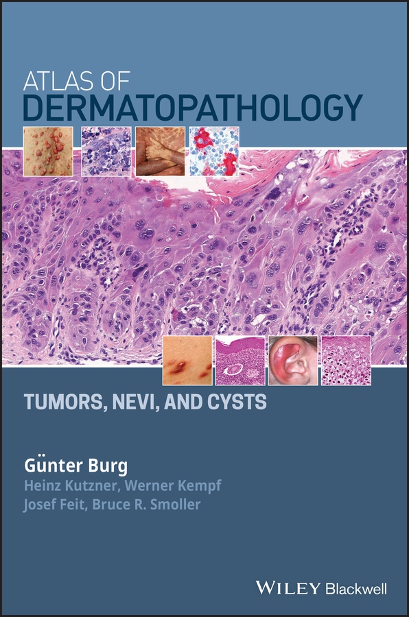 Обложка книги «Atlas of Dermatopathology»
