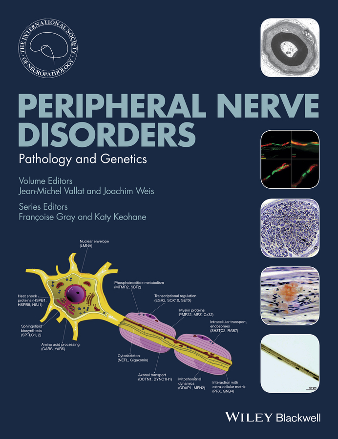 Обложка книги «Peripheral Nerve Disorders»