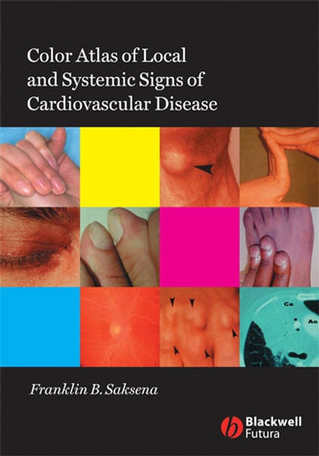 Обложка книги «Color Atlas of Local and Systemic Manifestations of Cardiovascular Disease»