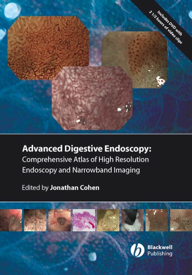 Обложка книги «Comprehensive Atlas of High Resolution Endoscopy and Narrowband Imaging»