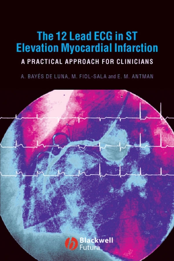 Обложка книги «The 12 Lead ECG in ST Elevation Myocardial Infarction»