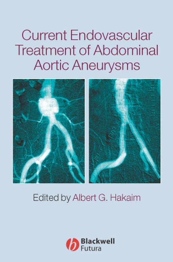 Обложка книги «Current Endovascular Treatment of Abdominal Aortic Aneurysms»