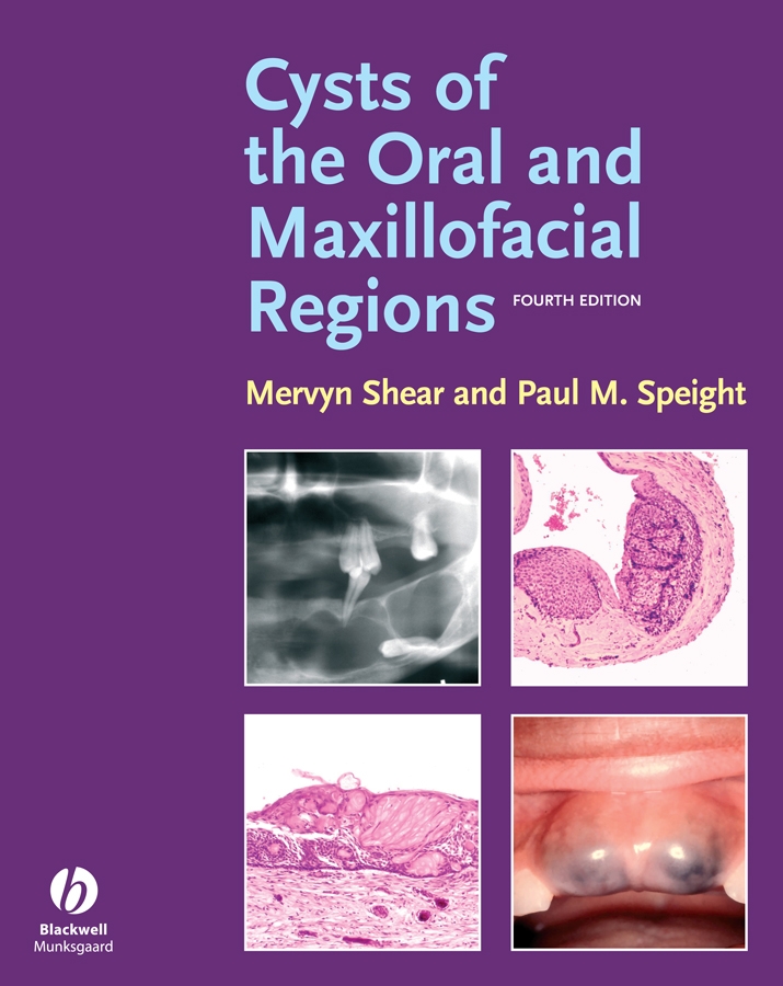 Обложка книги «Cysts of the Oral and Maxillofacial Regions»