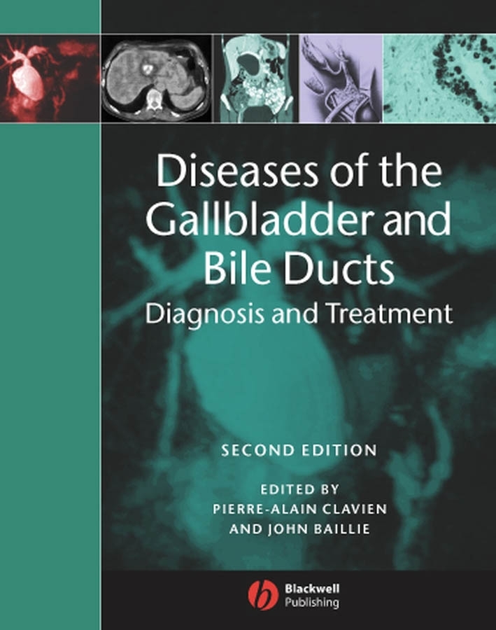 Обложка книги «Diseases of the Gallbladder and Bile Ducts»