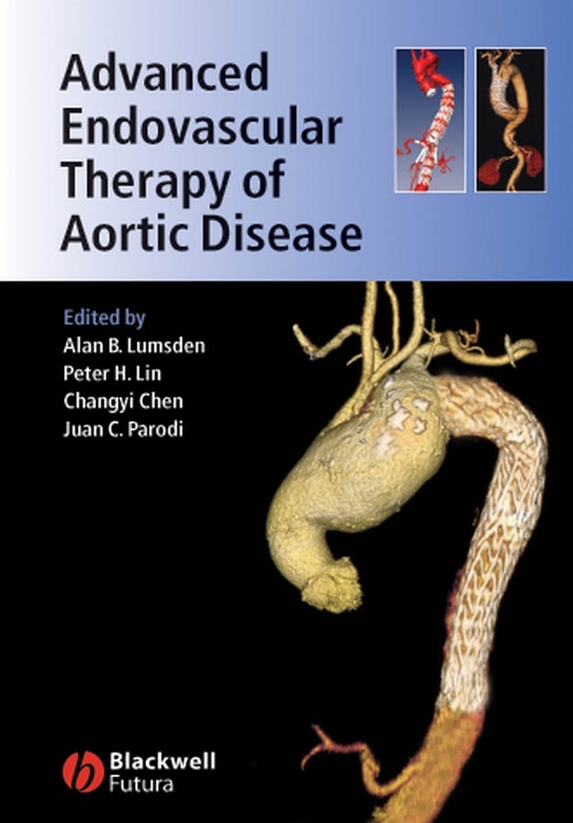 Обложка книги «Advanced Endovascular Therapy of Aortic Disease»
