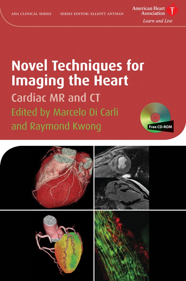 Обложка книги «Novel Techniques for Imaging the Heart»