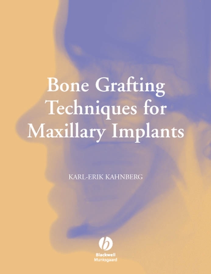 Обложка книги «Bone Grafting Techniques for Maxillary Implants»