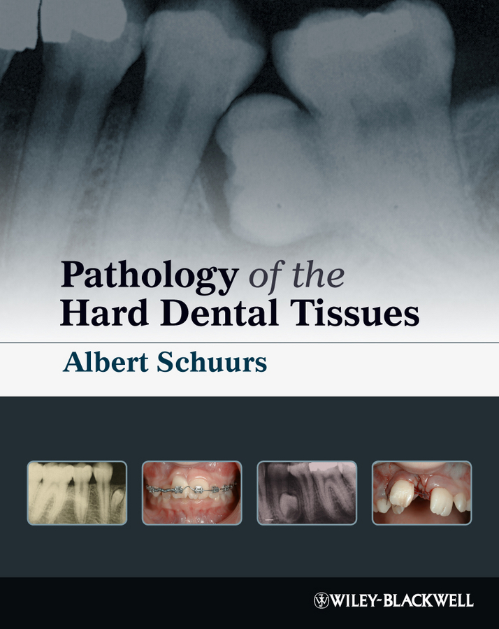 Обложка книги «Pathology of the Hard Dental Tissues»