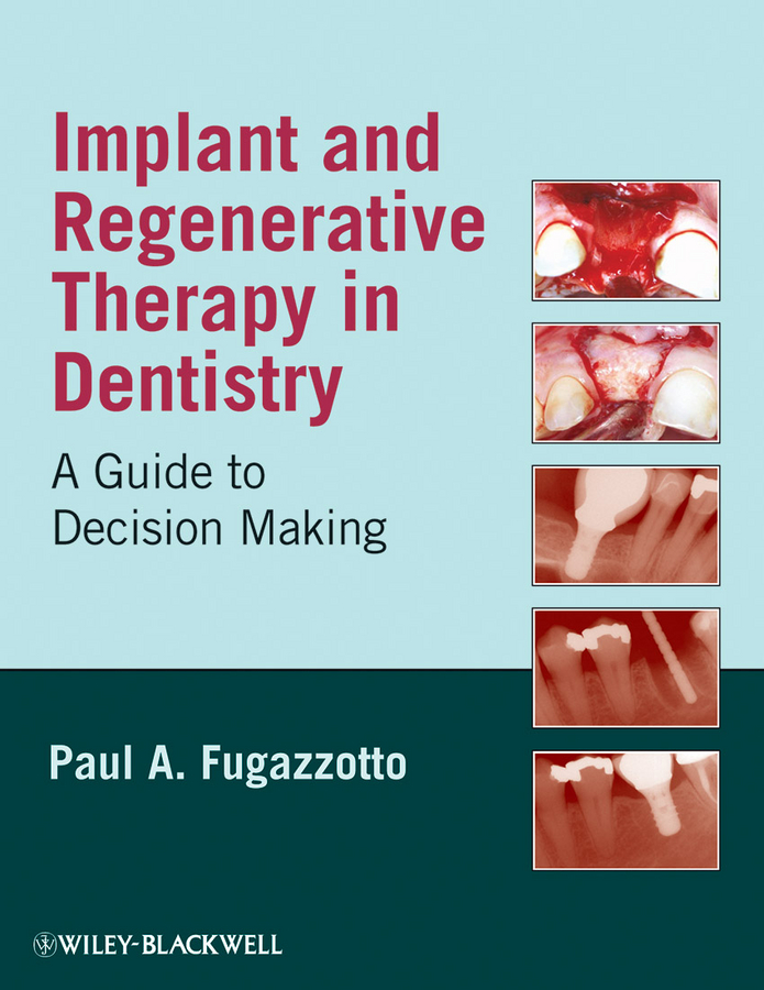 Обложка книги «Implant and Regenerative Therapy in Dentistry»