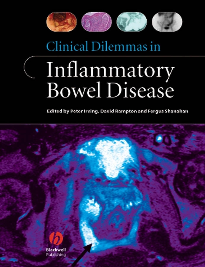 Обложка книги «Clinical Dilemmas in Inflammatory Bowel Disease»