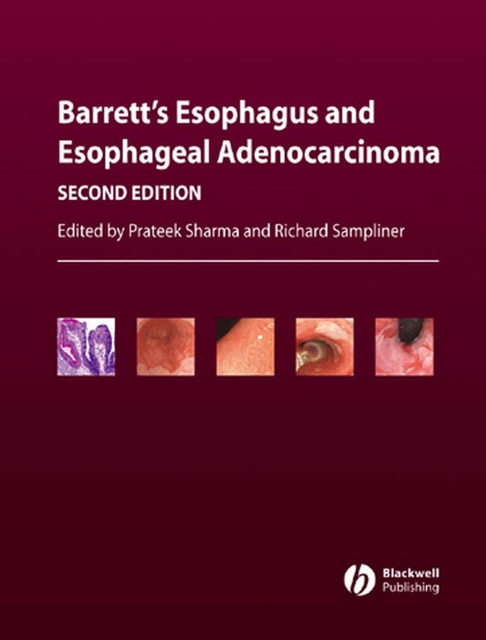 Обложка книги «Barrett's Esophagus and Esophageal Adenocarcinoma»