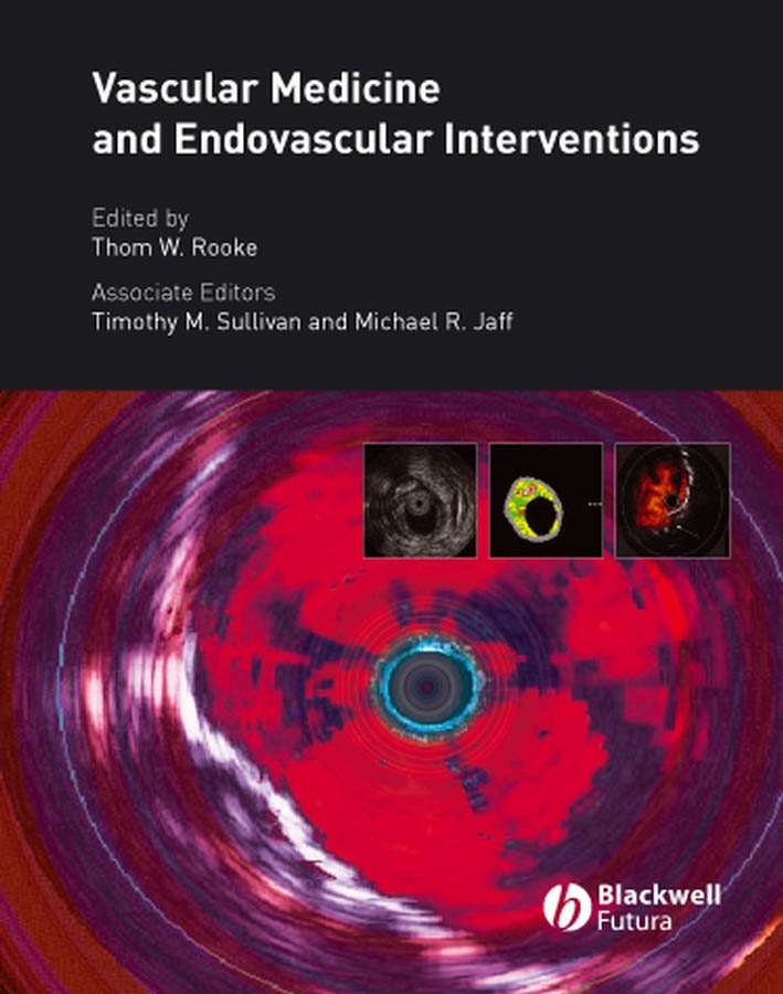 Обложка книги «Vascular Medicine and Endovascular Interventions»