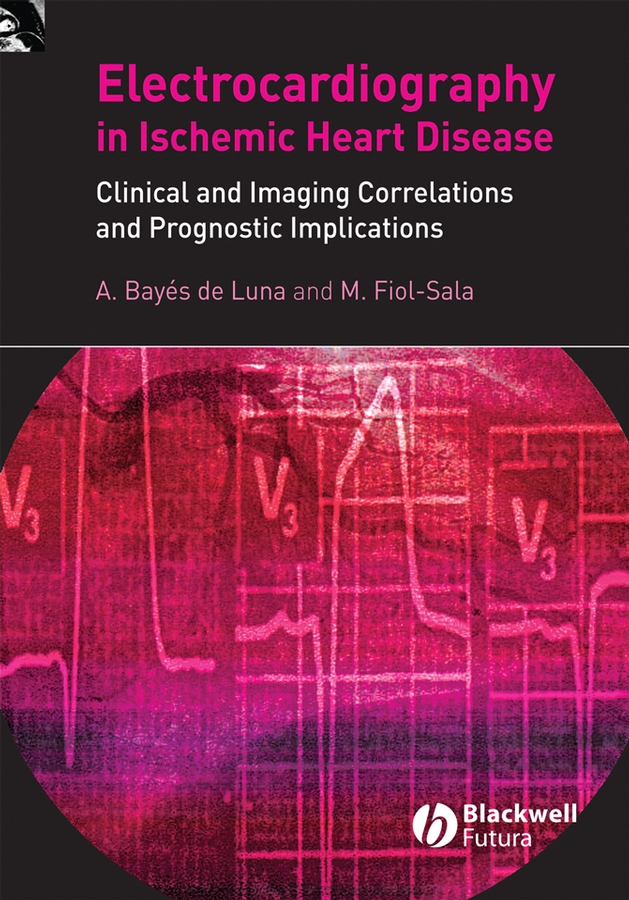 Обложка книги «Electrocardiography in Ischemic Heart Disease»