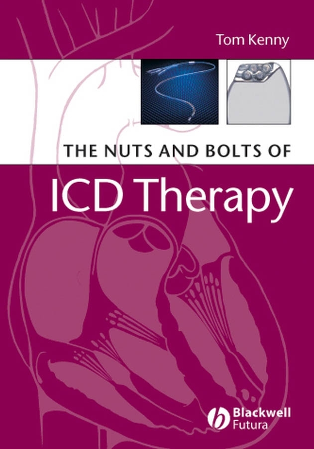 Обложка книги «The Nuts and Bolts of ICD Therapy»