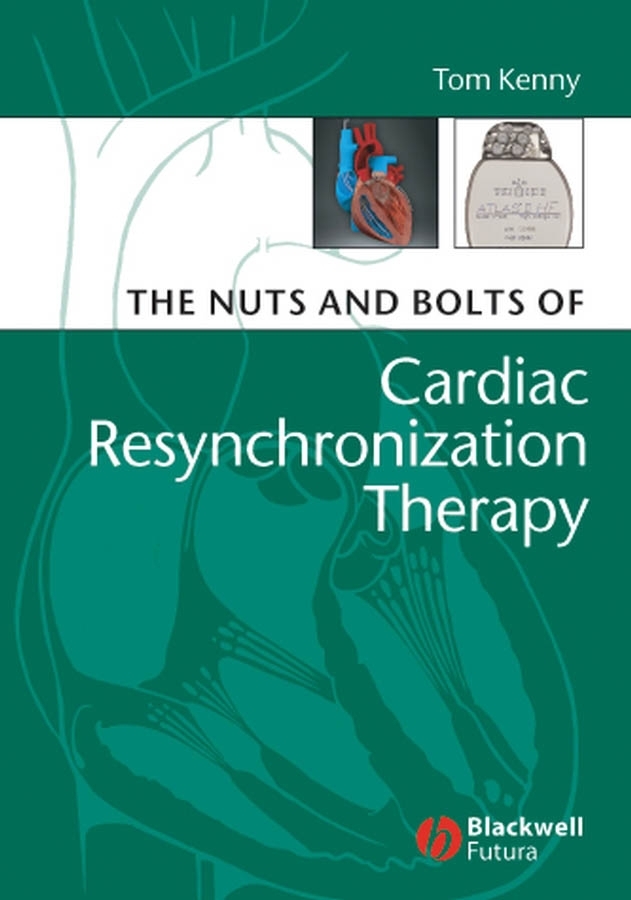 Обложка книги «The Nuts and Bolts of Cardiac Resynchronization Therapy»