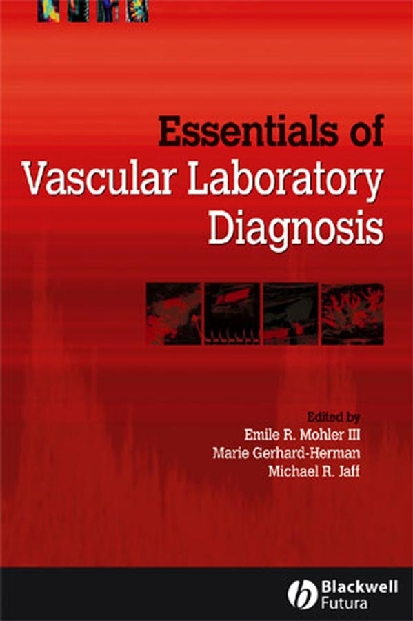 Обложка книги «Essentials of Vascular Laboratory Diagnosis»