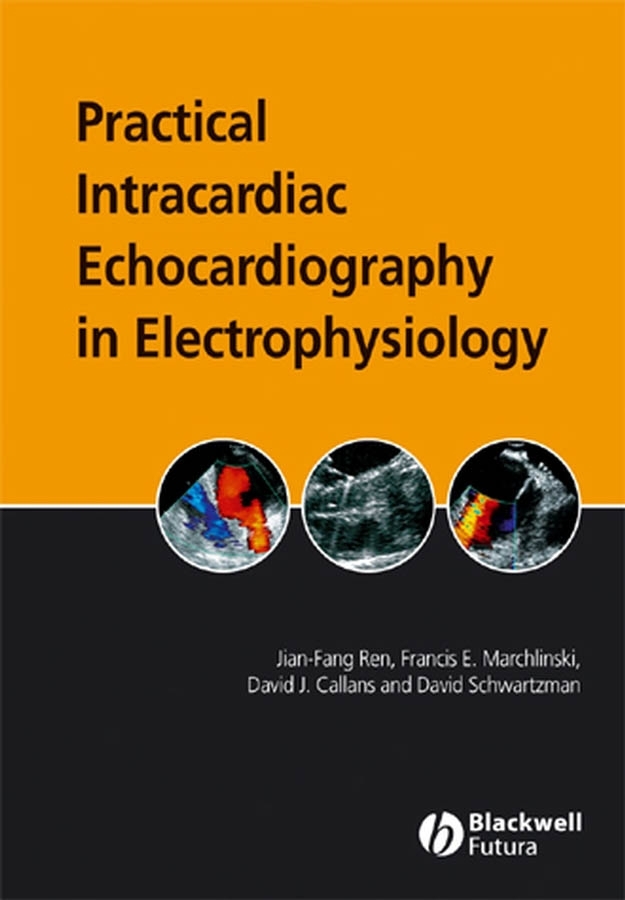Обложка книги «Practical Intracardiac Echocardiography in Electrophysiology»