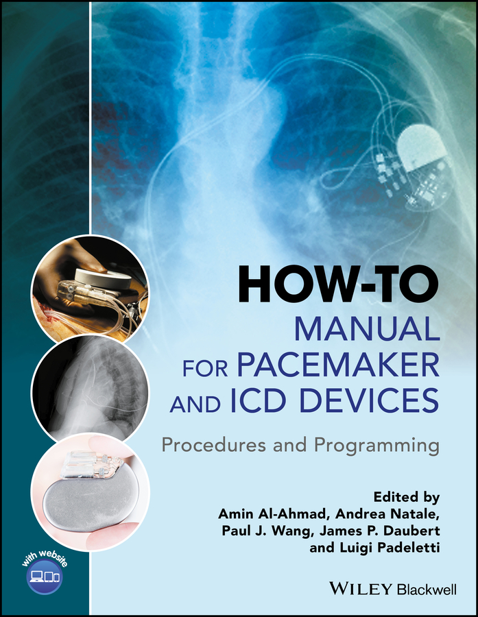 Обложка книги «How-to Manual for Pacemaker and ICD Devices»