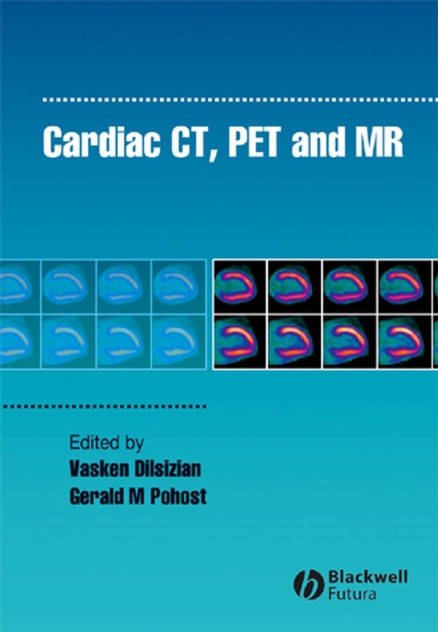 Обложка книги «Cardiac CT, PET and MR»