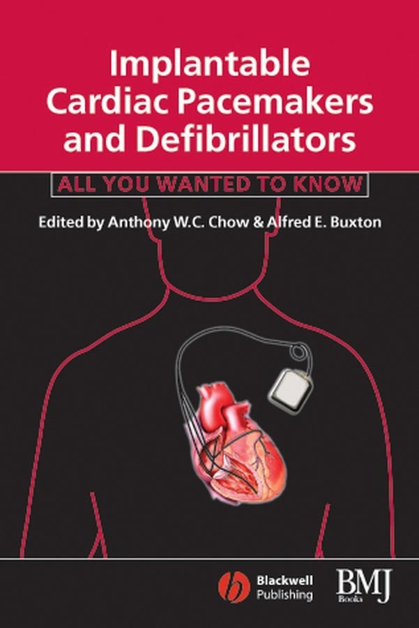 Обложка книги «Implantable Cardiac Pacemakers and Defibrillators»