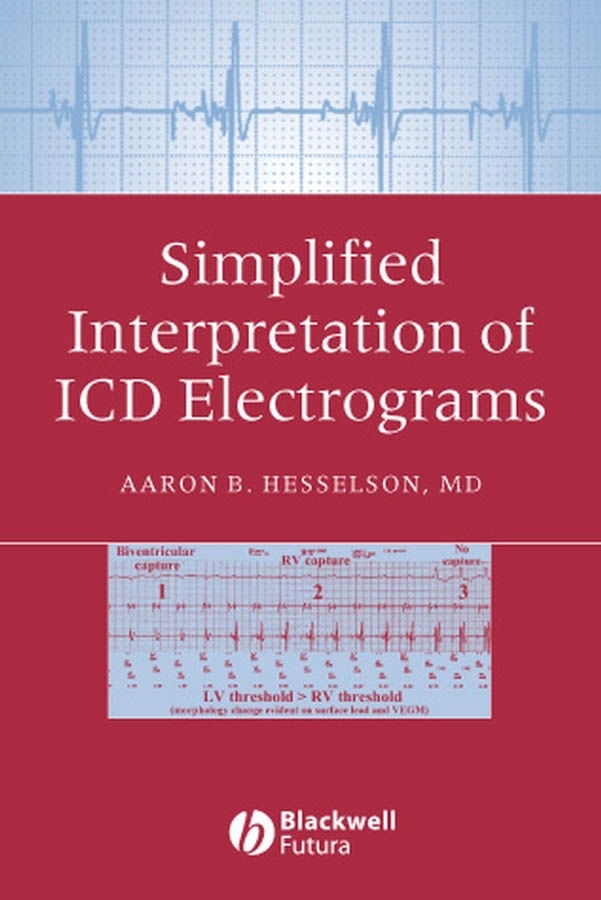 Обложка книги «Simplified Interpretation of ICD Electrograms»