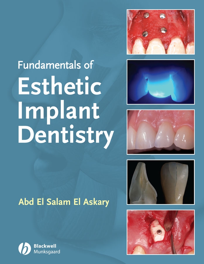 Обложка книги «Fundamentals of Esthetic Implant Dentistry»