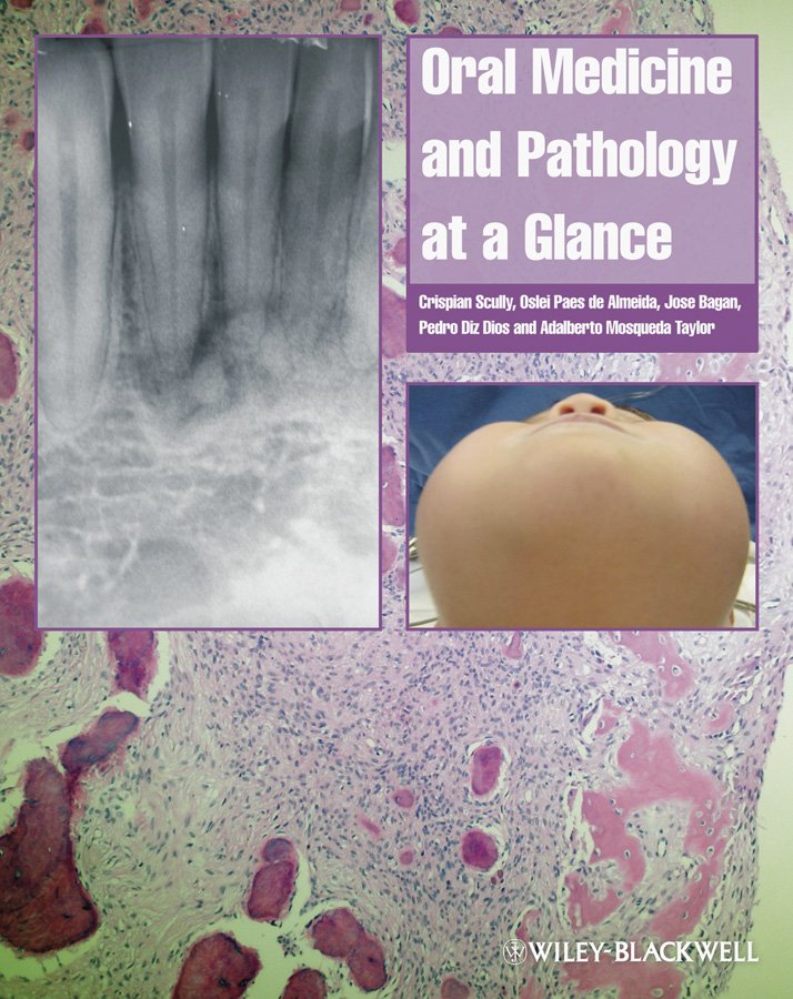 Обложка книги «Oral Medicine and Pathology at a Glance»