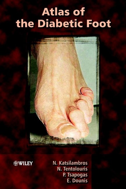 Обложка книги «Atlas of the Diabetic Foot»