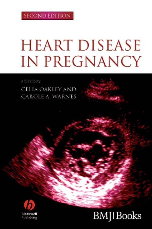 Обложка книги «Heart Disease in Pregnancy»